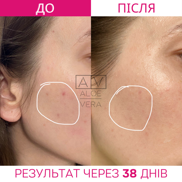Сироватка для обличчя з інтенсивним доглядом 20% вітаміну С Theramid C-Tetra E.F. 30 мл THE43449 фото