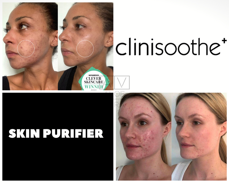 Спрей-очиститель для кожи Clinisoothe+ Skin Purifier 100 мл CS03013 фото