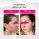Консультація по підбору догляду за обличчям в ALOE VERA з підтримкою 2 місяці CONSULTATION-2 фото 8