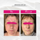 Консультація по підбору догляду за обличчям в ALOE VERA з підтримкою 2 місяці CONSULTATION-2 фото 2