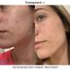 Засіб для лікування постзапальної еритеми Transparent Lab PIE Acne Red Spot Fading Treatment 30 мл TL43208 фото 2