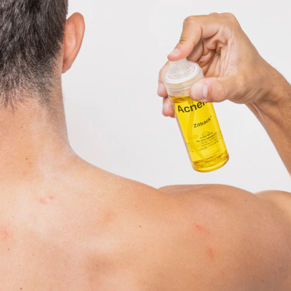 Спрей для проблемной кожи тела с акне Acnemy ZITBACK Body Spray for Acne-Prone Skin 80 мл AC43324 фото
