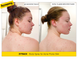 Спрей для проблемной кожи тела с акне Acnemy ZITBACK Body Spray for Acne-Prone Skin 80 мл AC43324 фото 2
