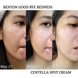 Крем для точкового застосування з центелою азіатською Benton Goodbye Redness Centella Spot Cream 15 г BN0563 фото 2