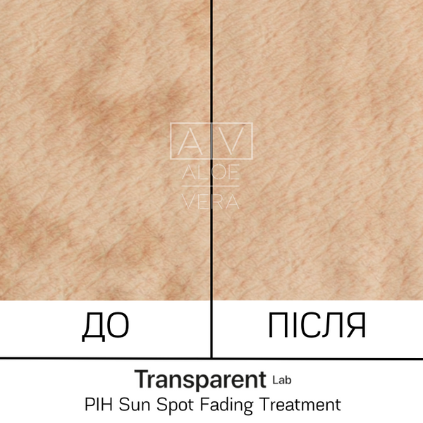 Засіб для боротьби з постзапальною гіперпігментацією Transparent Lab PIH Sun Spot Fading Treatment 30 мл TL43218 фото