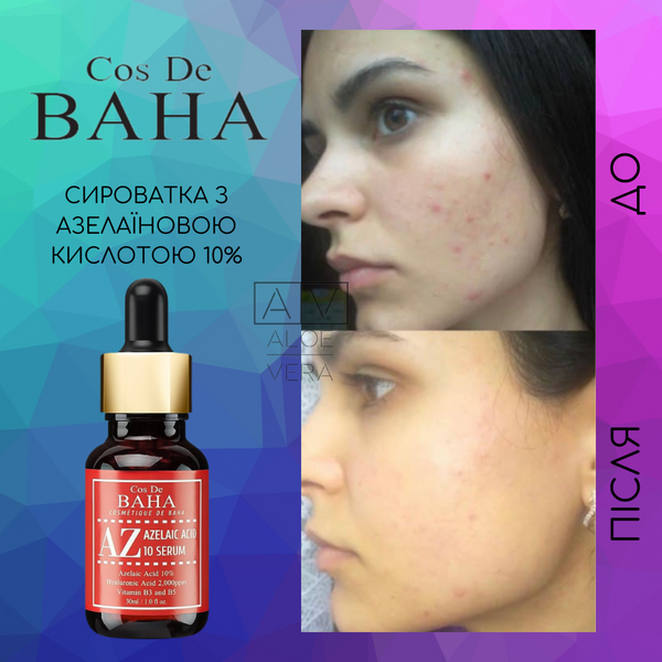 Сироватка для обличчя з азелаїновою кислотою проти акне та запалень Cos De BAHA Azelaic Acid 10% Serum 30 мл CDB1078 фото