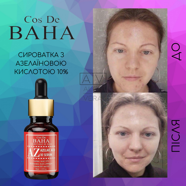 Сыворотка для лица с азелаиновой кислотой против акне и воспалений Cos De BAHA Azelaic Acid 10% Serum 30 мл CDB1078 фото