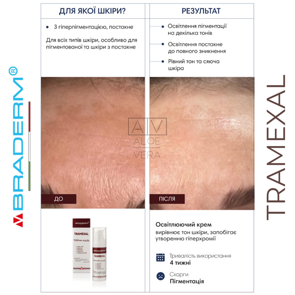 Осветляющий крем против пигментации Braderm Tramexal Cream 30 мл BDTRAMEXAL фото